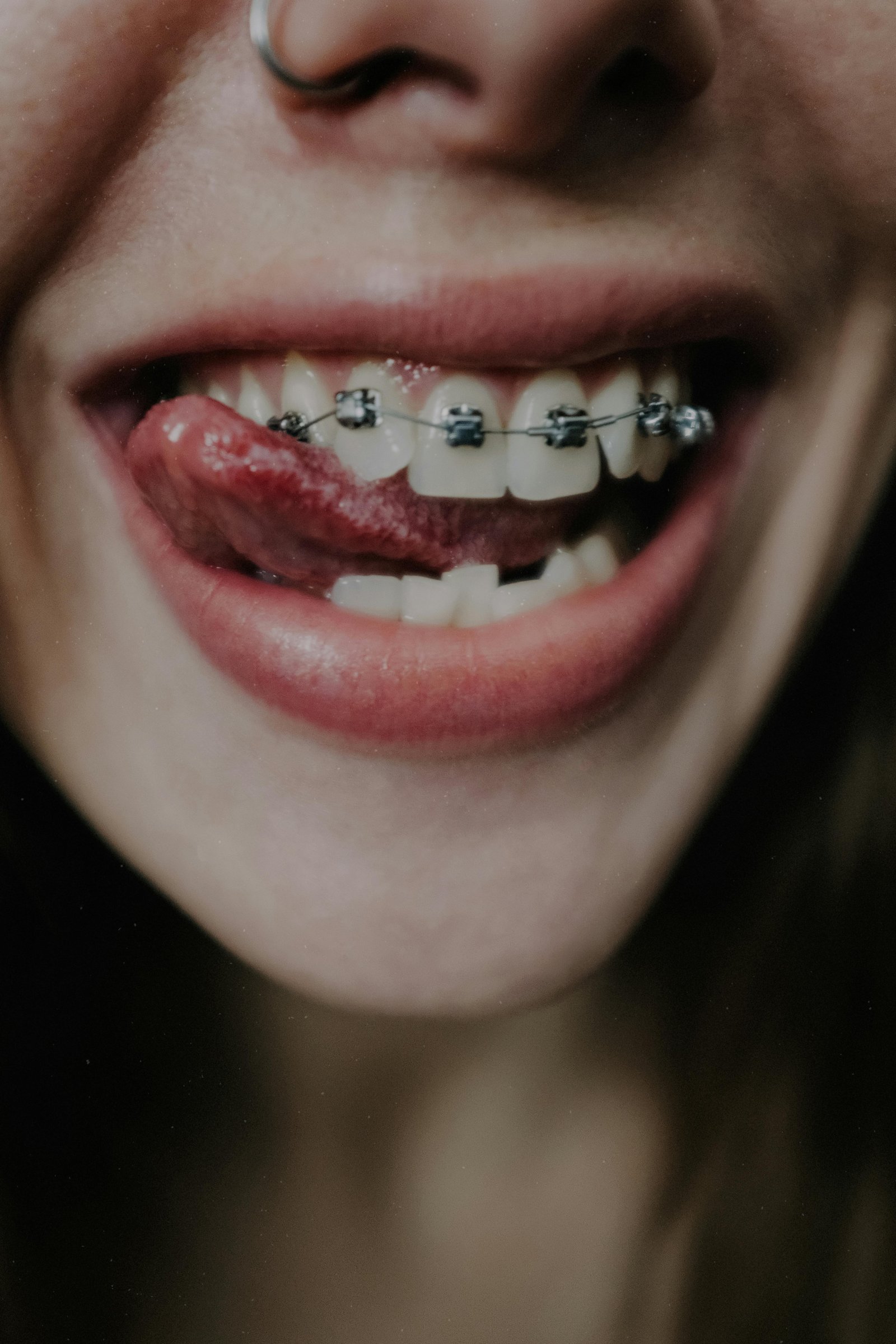 Orthodontic braces consultation and alignment planning